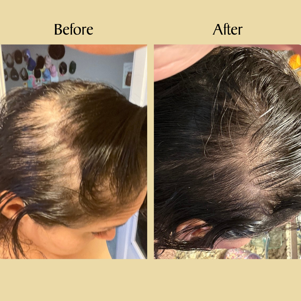 Veganic Hair Growth Bundle - Flash Sale