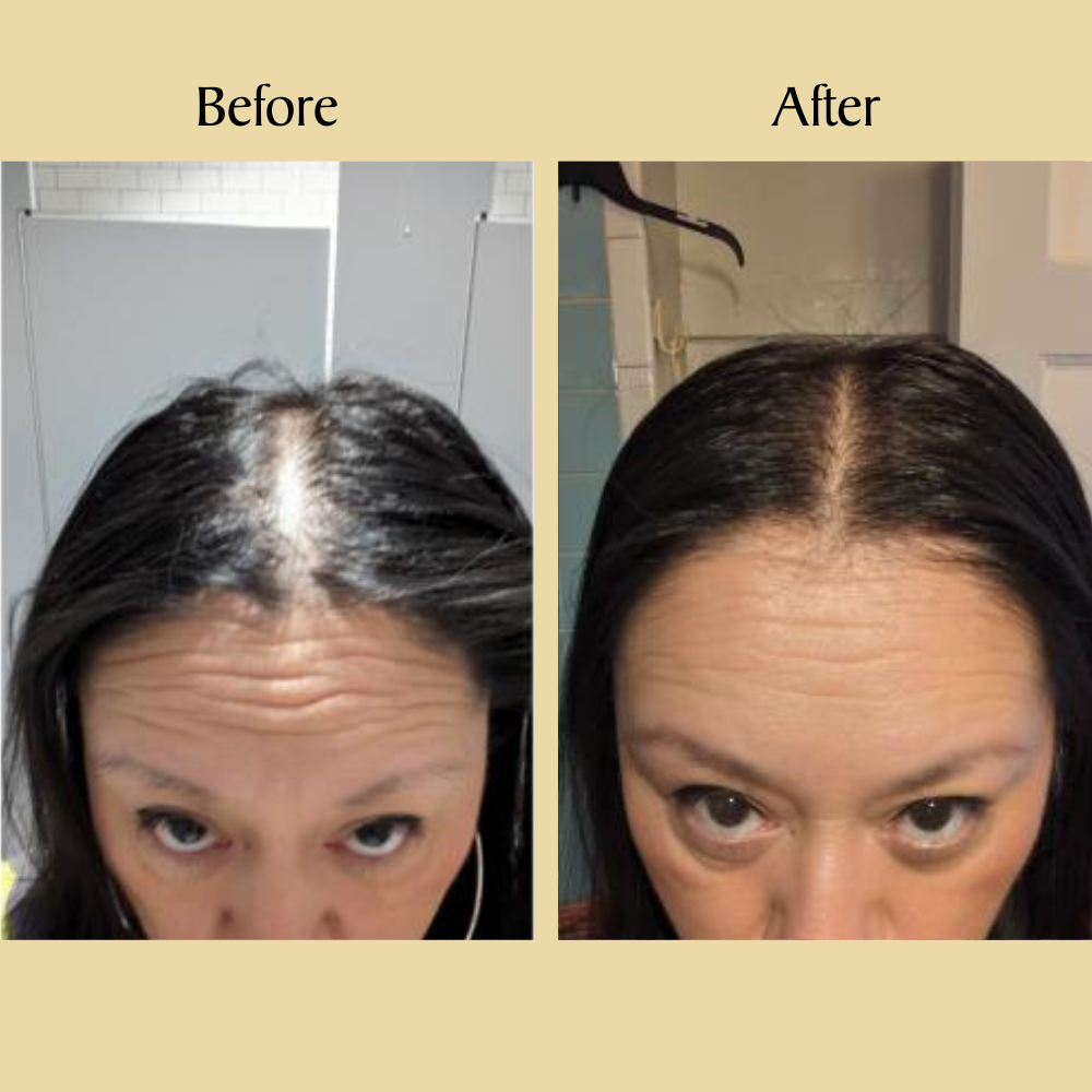 Veganic Hair Growth Bundle - Flash Sale